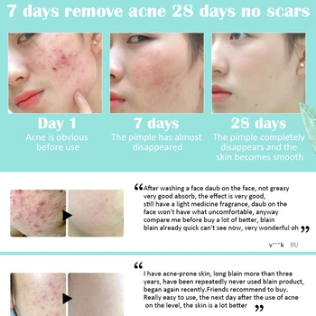 FTEENPLY Tratamiento del Acné del Rostro de la Cicatriz Quitar Crema para la Cara que la Decoloración de las Marcas de Acné de Reparacion de Nutrir Refinar los Poros de la Esencia del Cuidado de la Piel