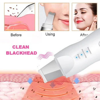 Depurador de la piel de Limpieza Facial Máquina de Pelar Espinilla del Removedor del Poro Limpiador de LED Anti Envejecimiento Facial Masajeador EMS Mesoterapia